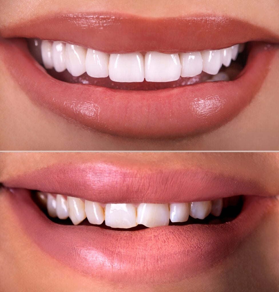 iStock 1303468757