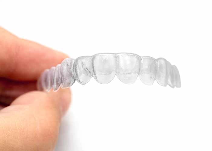SMILE MAKEOVER IN PALM BEACH GARDENS 12 INVISIBLE BRACES
