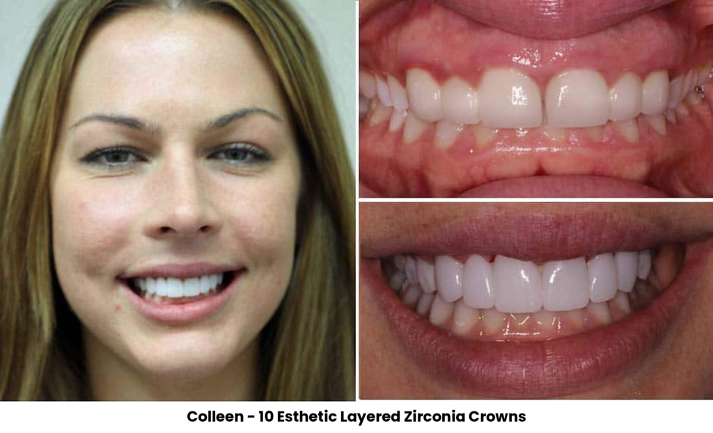 TOP 20 COLLEEN