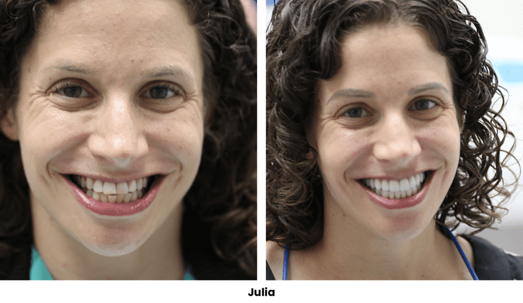 TOP 26 JULIA
