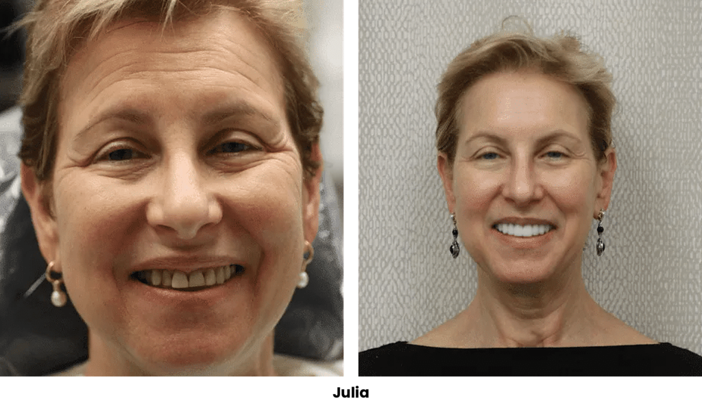 TOP 27 JULIA