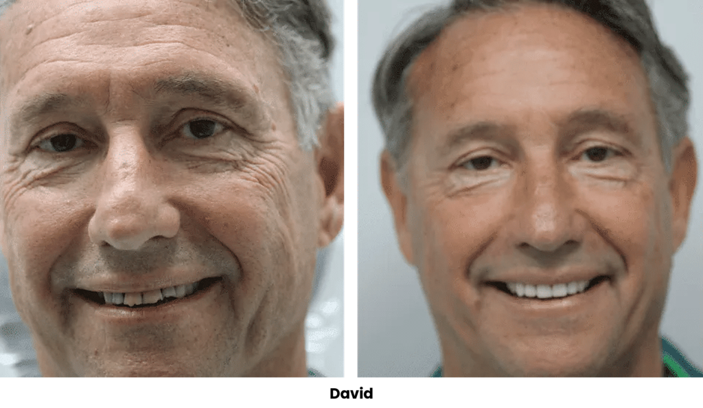 TOP 30 DAVID