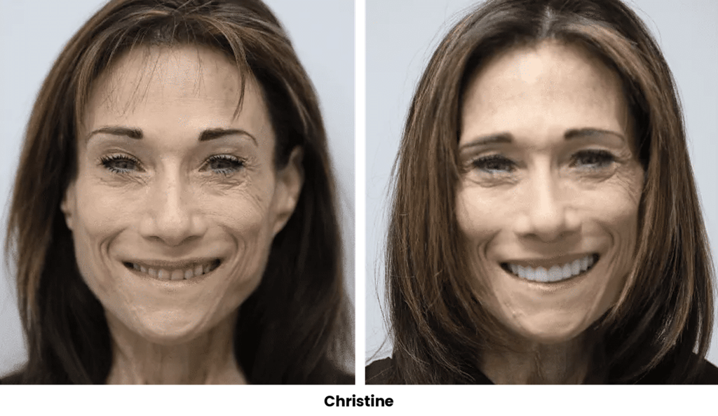 TOP 31 CHRISTINE